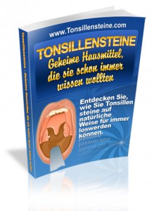 Tonsillensteine auf natürliche Weise loswerden Tonsillensteine loswerden