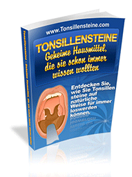 Mandelsteine Tonsillensteine entfernen